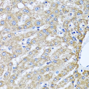 TMEM189 Antibody