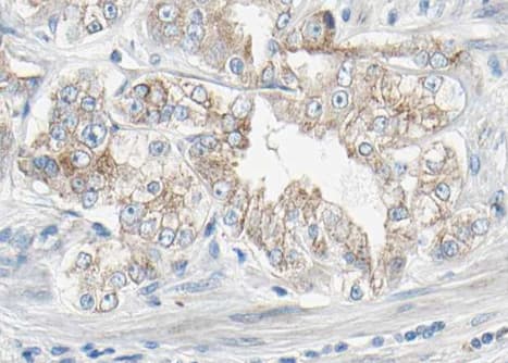 Polyclonal Rabbit anti-Human PDGFRB / PDGFR Beta Antibody (phospho-Tyr1021, IHC, WB)