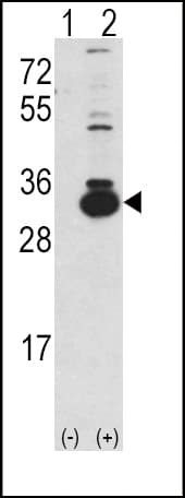 KHK / Ketohexokinase Antibody (aa251-281)