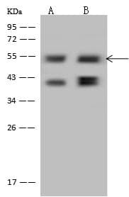 Polyclonal Rabbit anti-Human PPHLN1 Antibody (IF, WB)