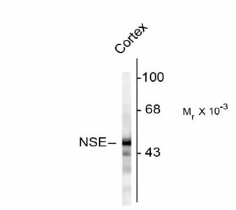 Polyclonal Rabbit anti-Human ENO2 / NSE Antibody (IF, WB)