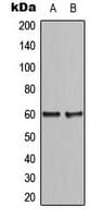 Polyclonal Rabbit anti-Human CCDC102B Antibody (Internal, IHC, WB)