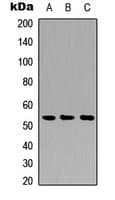 CTSA / Cathepsin A Antibody (Internal)