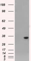 Monoclonal Mouse anti-Human AKR1A1 Antibody (clone OTI4G2, IHC, WB)