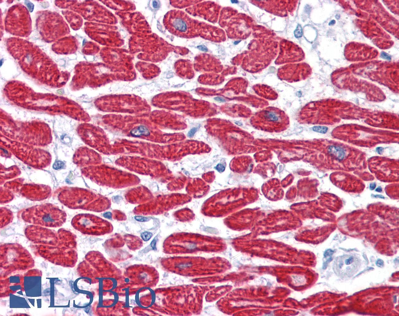 IHC-plus™ MYL3 Antibody (aa2-195, clone 7C1)