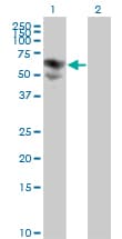 BTD / Biotinidase Antibody (clone 3B10-2B3)