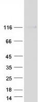 Human ITGA2B / CD41 Protein (Recombinant Myc-DDK (Flag))