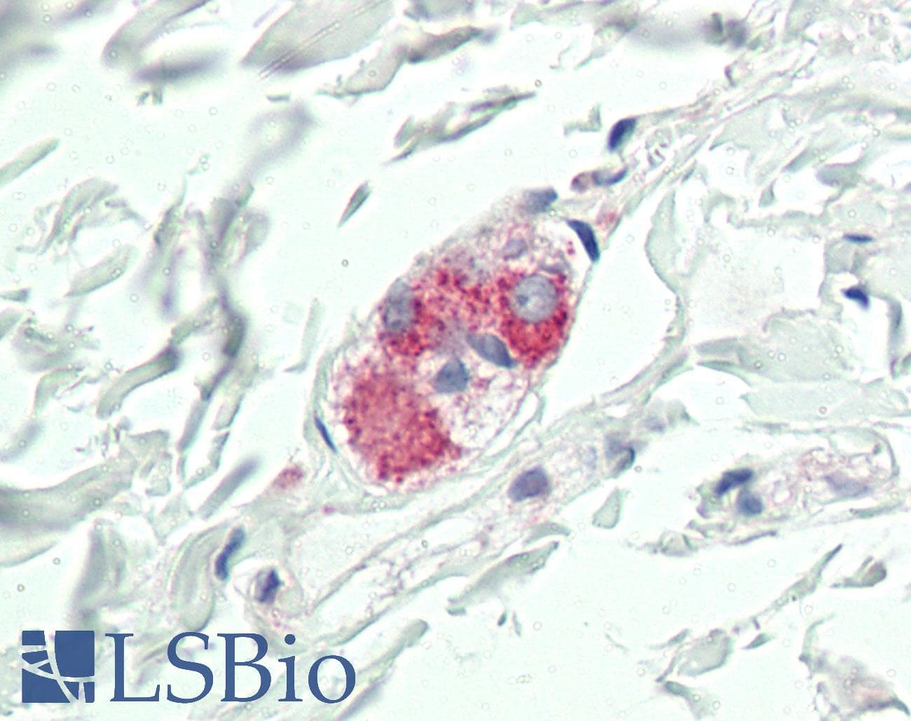 IHC-plus™ CYR61 Antibody (aa47-332)