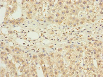 Polyclonal Rabbit anti-Human NBR1 Antibody (IHC)