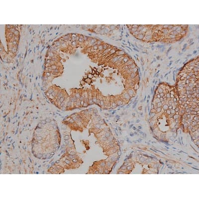 MAPT / Tau Antibody (phospho-Ser404)