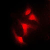 NFKBIA / IKB Alpha / IKBA Antibody (N-Terminus)
