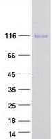 Human ENPP3 / CD203c Protein (Recombinant Myc-DDK (Flag))