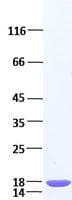 Human IL-1B / IL-1 Beta Protein (Recombinant)