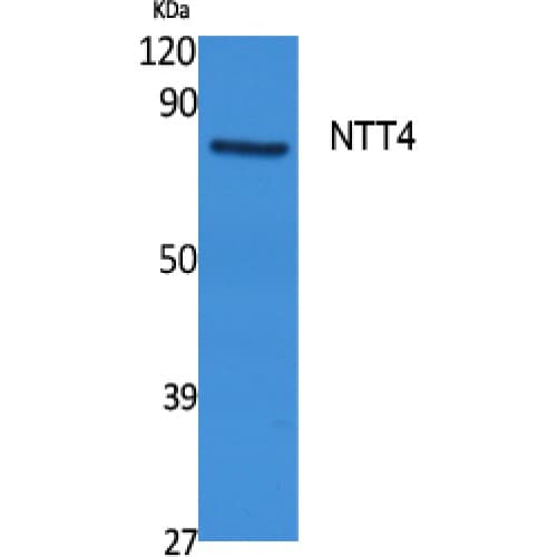 Polyclonal Rabbit anti-Human SLC6A17 Antibody (240-320 aa, Internal, WB)