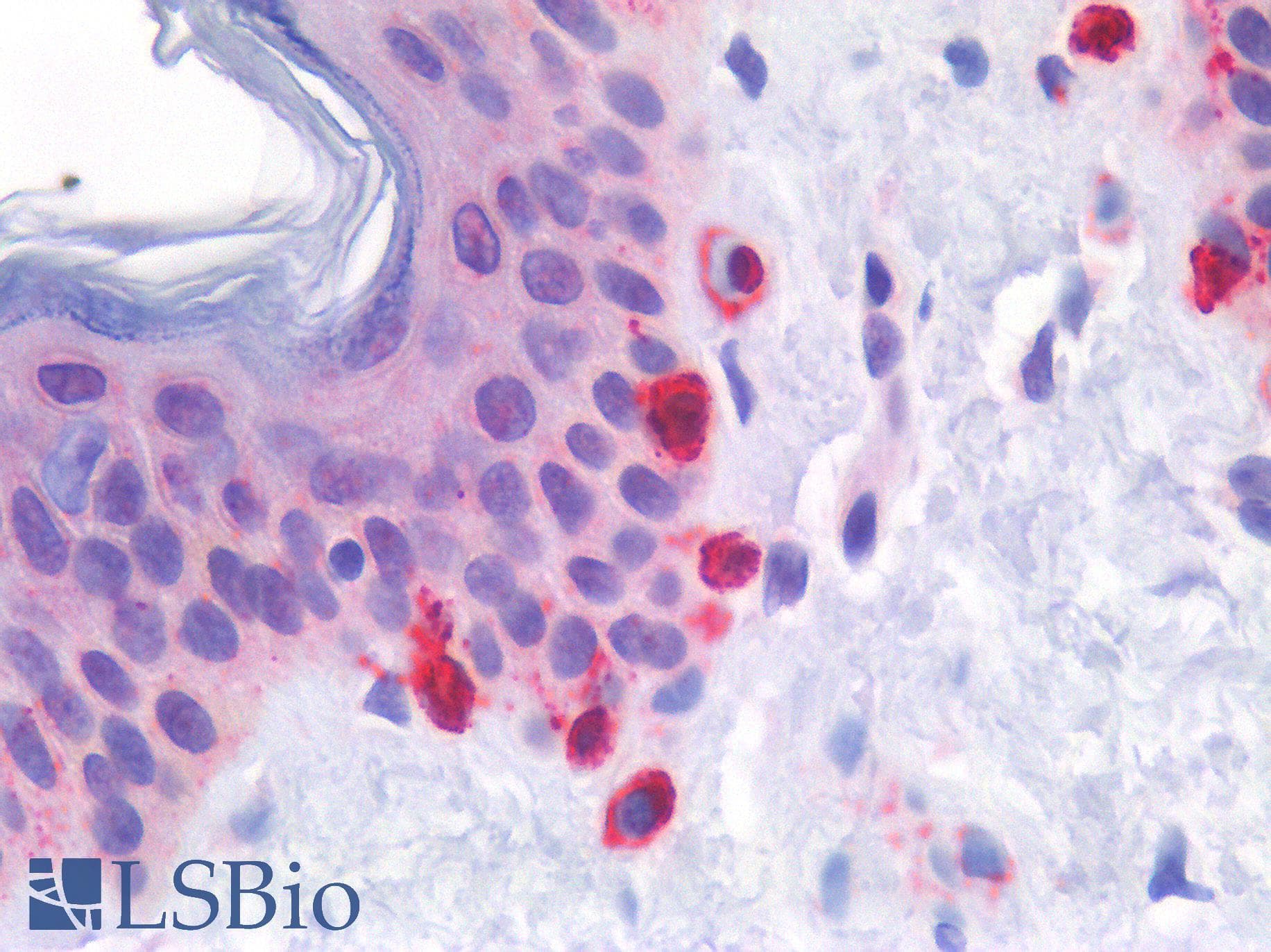 PathPlus™ TYRP1 / gp75 Antibody (aa396-445)