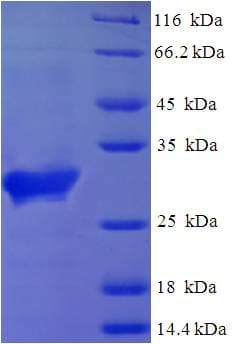 Human STH Protein (Recombinant His-SUMO)
