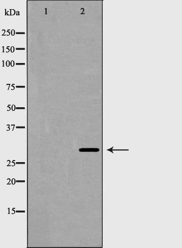 Polyclonal Rabbit anti-Human HOXB5 Antibody (WB)