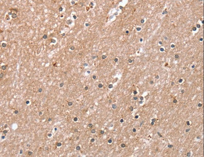 Polyclonal Rabbit anti-Human RAB8A / RAB8 Antibody (IHC, WB)