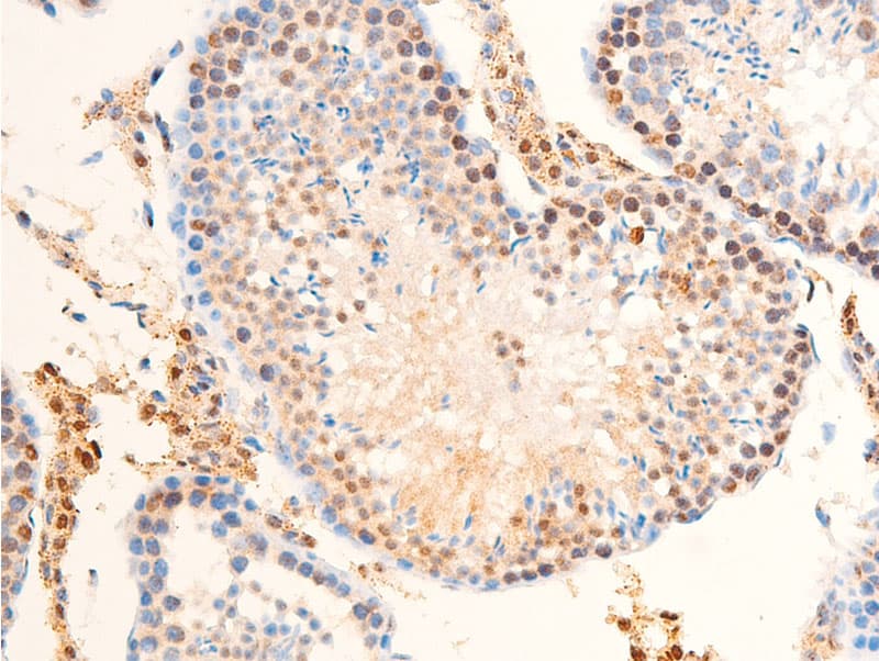 ERBB2 / HER2 Antibody (phospho-Tyr1248)