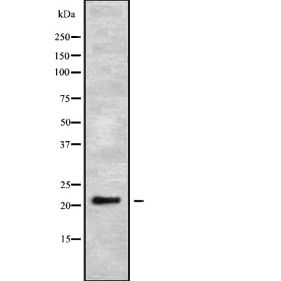 PSF1 / GINS2 Antibody