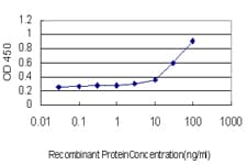 IHC-plus™ ADAM17 / TACE Antibody (clone 1F6)