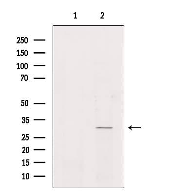 Polyclonal Rabbit anti-Human NKX6-2 Antibody (WB)