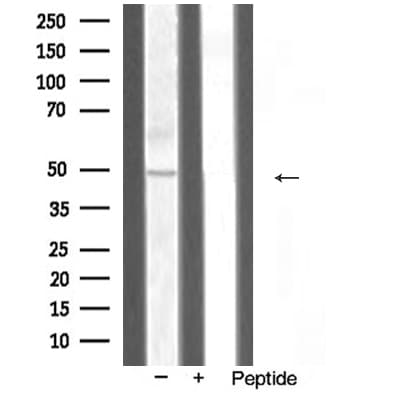 Polyclonal Rabbit anti-Human TRAF1 Antibody (IHC, WB)