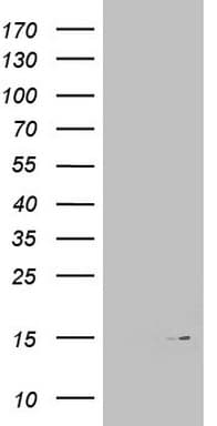 Monoclonal Mouse anti-Human MAP1LC3A / LC3A Antibody (clone OTI10H6, IHC, WB)