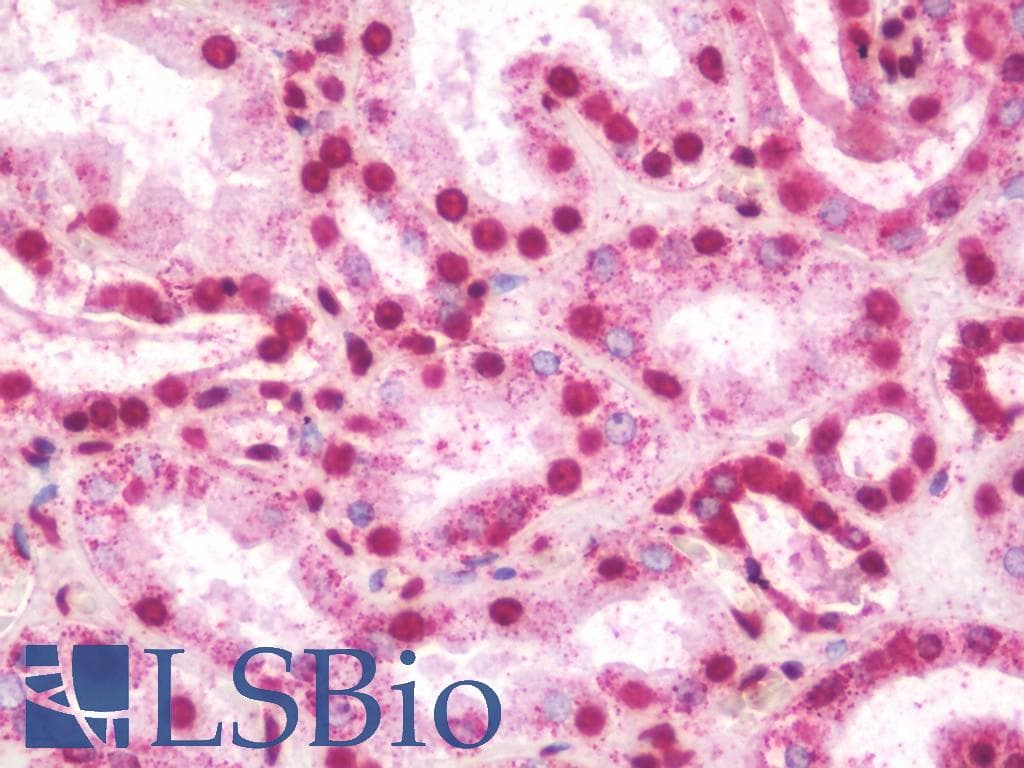 ABL1 / c-ABL Antibody (phospho-Tyr412)