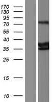 LPPR5 Protein (Over-Expression Lysate Myc-DDK (Flag))