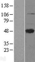 Human CLEC4M / L-SIGN / CD299 Protein (Over-Expression Lysate Myc-DDK (Flag))