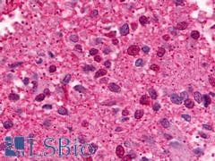 PathPlus™ Polyclonal Rabbit anti-Human GALR3 / Galanin Receptor 3 Antibody (C-Terminus, IHC)