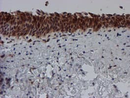 SAT2 Antibody (clone OTI1C9)