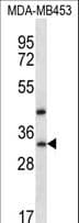 Polyclonal Rabbit anti-Human TAF9B Antibody (aa44-72, WB)