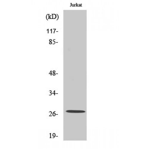 Polyclonal Rabbit anti-Human KCNMB2 Antibody (120-200 aa, Internal, IHC, WB)