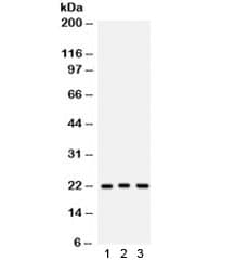 PRDX5 / Peroxiredoxin 5 Antibody