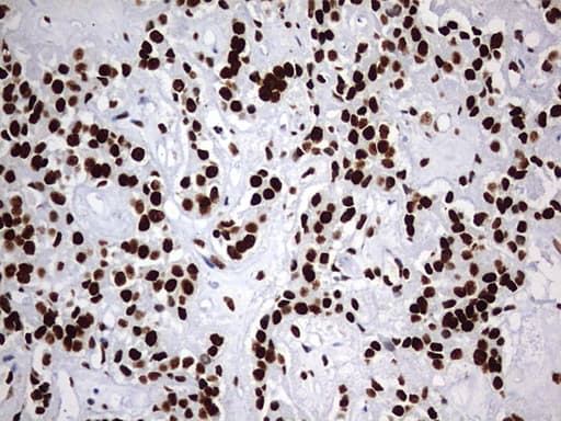Monoclonal Mouse anti-Human HNRPM / HNRNPM Antibody (clone OTI1F6, aa1-261, IHC, WB)