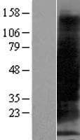 MT1B Protein (Over-Expression Lysate Myc-DDK (Flag))