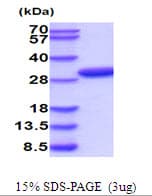 Mouse Latexin / MUM Protein (Recombinant His)