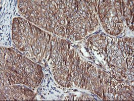 ACAA2 Antibody (clone OTI1B1)