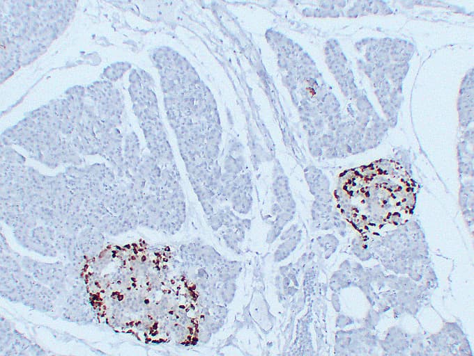 GCG / Glucagon Antibody (clone ABT-GCG)