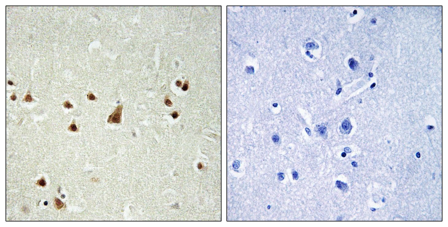 ANKRD26 Antibody