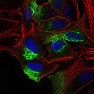 ZEB1 / AREB6 Antibody (aa967-1108, clone 2A8H3)