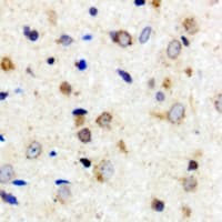 PAK3 Antibody (Internal)
