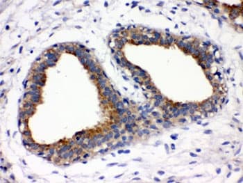 FUT1 / HSC Antibody