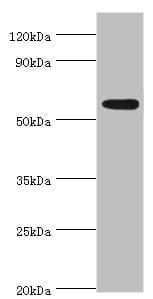 Polyclonal Rabbit anti-Human PARP3 Antibody (aa294-533, IHC, WB)
