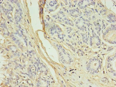 AURKB / Aurora-B Antibody