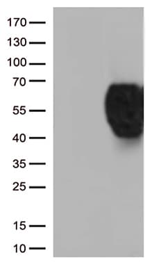 BTLA / CD272 Antibody (aa31-157+Mouse, clone OTI2H5)