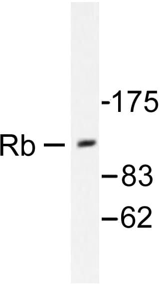 RB1 / Retinoblastoma / RB Antibody (Pro789)