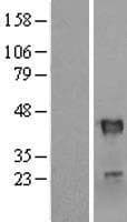 RNF113B Protein (Over-Expression Lysate Myc-DDK (Flag))